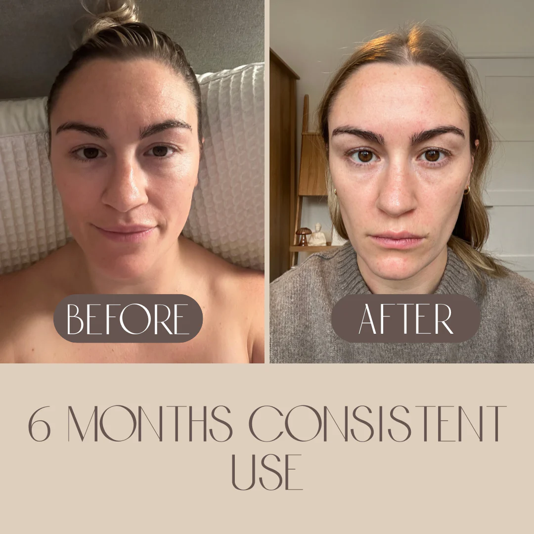 Bian Stone Facial Gua Sha - Image 6