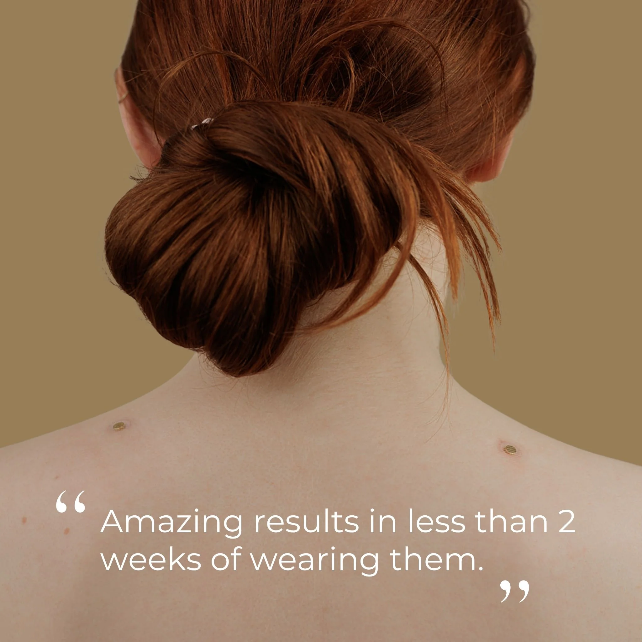 Gold Acupressure Magnet Patches - Image 7